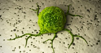 US FDA approves novel therapy for estrogen receptor-positive breast cancer tumor tumour green_Featured