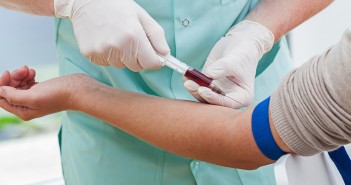 Urgent need to develop independent biomarkers for functional, diagnostic and prognostic application in oncology research Clinical_Featured