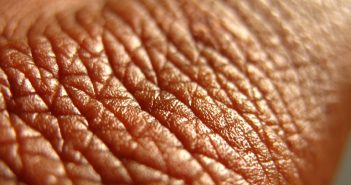 Proteomics analysis could help diagnose inflammatory skin diseases skin close up