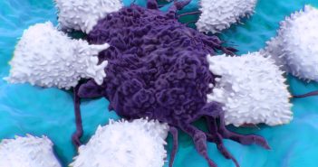 Signal amplification technology reveals previously undetectable proteins of disease Cancer immune 'hotspots'