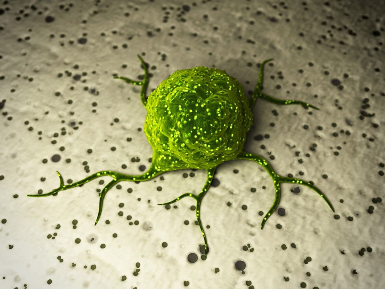 Colorectal tumor management: can new biomarkers predict the most