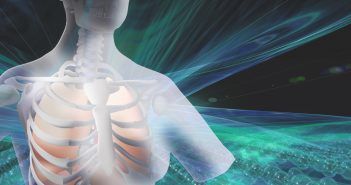 On-line monitoring human breath acetone during exercise and diet by proton transfer reaction mass spectrometry diagram-of-lungs-in-ribcage