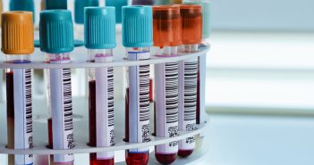 Bioanalysis of biopharmaceuticals and biomarkers feature