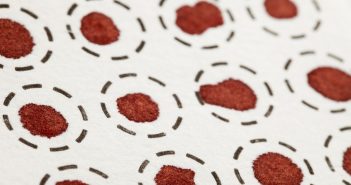 Spotting of external calibration standards on blank dried blood spots as a resource-sparing protocol dried blood spots