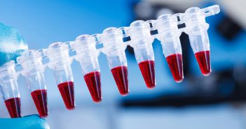 Microsampling: considerations for its use in pharmaceutical drug discovery and development Samples-bioanalytical-samples