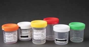 Thermo Fisher Scientific unveil their new Samco clicktainer vials for enhanced sample protection and user safety IMG_0524