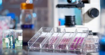 T-cell fraction: a quantitative technique to predict risk of melanoma recurrence? t-cell fraction-well