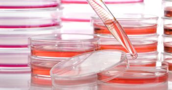 Micro-SPE in pipette tips as a tool for analysis of small-molecule drugs in serum cancer reserch pipette petri dish