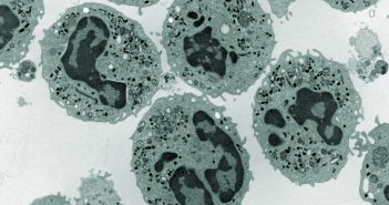 Cryo-electron microscopy research awarded Nobel Prize in Chemistry 2017 Electron Microscopy Photography human Neutrophils 150009971