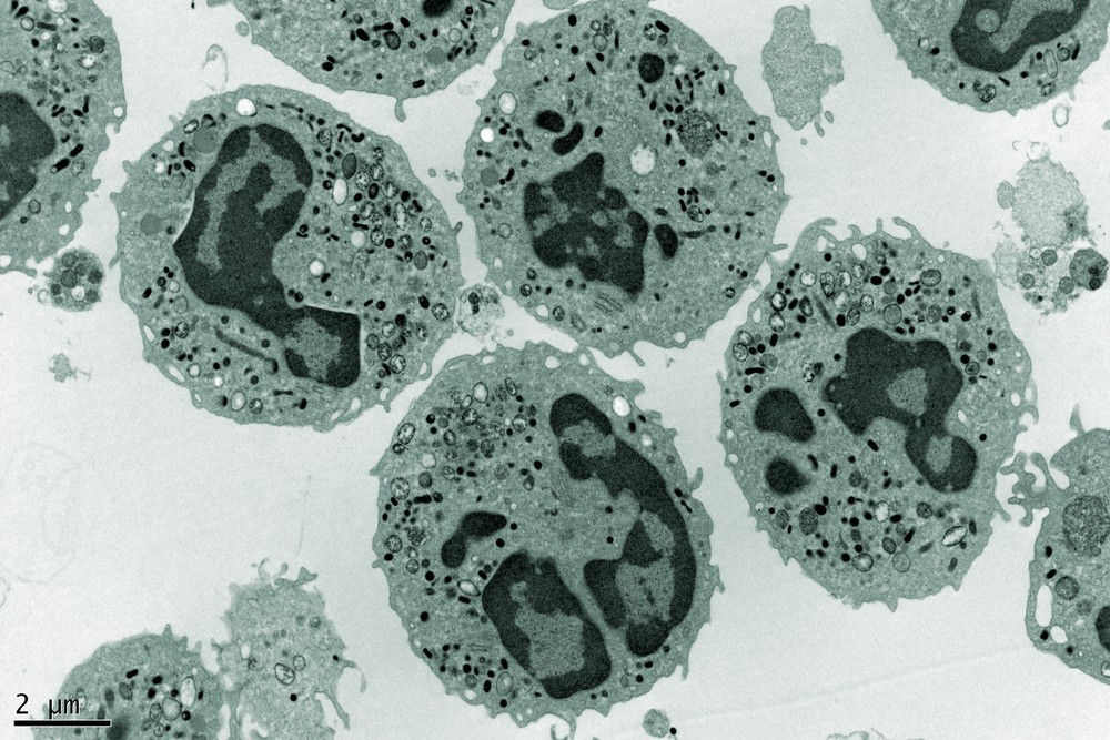 cryo electron microscopy research awarded nobel prize in chemistry cryo electron microscopy