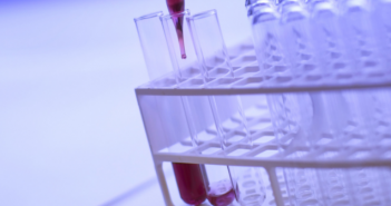 Synthetic cannabinoids in biological specimens: a review of current analytical methods and sample preparation techniques toxicology