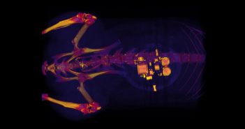 Implantable device developed to treat bladder problems Washington University
