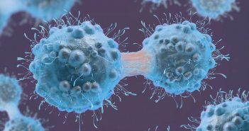 New diagnostic technique identifies biomarker for bladder cancer cancer cell