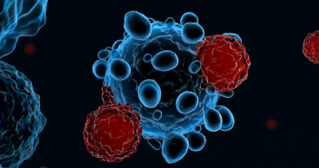 CAR-T cell development: an interview with Michael Schwenkert CAR-T