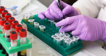 Key challenges in sample preparation for peptide bioanalysis: a podcast with Mary Lame laboratory-3827745_1920