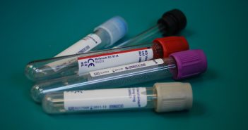New rapid blood test could identify active tuberculosis infections TB-test