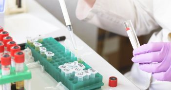 Ensuring biological sample integrity from collection to analysis for LC–MS workflows: case studies illustrating challenges in clinical trials luciferase-assay