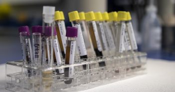 Blood biomarker test could identify worsening multiple sclerosis blood biomarker sample tubes in rack