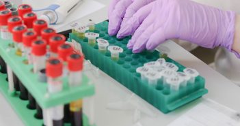 Are sugars the key to an early, accurate prostate cancer test? blood-test-samples-lab