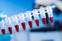 Neuro biomarker levels measured with high-sensitivity digital ELISA differ between serum and plasma bioanalytical-samples 160177076_no-numbers