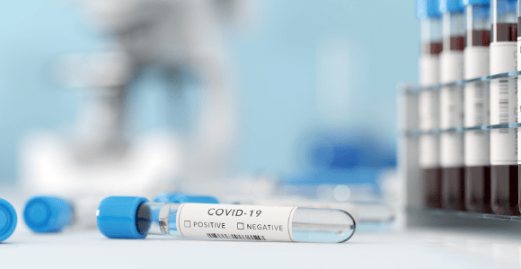 COVID-19 blood biomarkers for screening and treatment