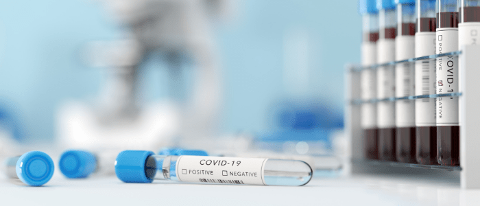 COVID-19 blood biomarkers for screening and treatment