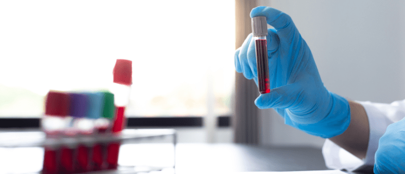 lc-ms-ms-assay-of-fluoropezil-and-its-two-major-metabolites-in-human