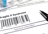 Blood biomarkers for Fragile X Syndrome