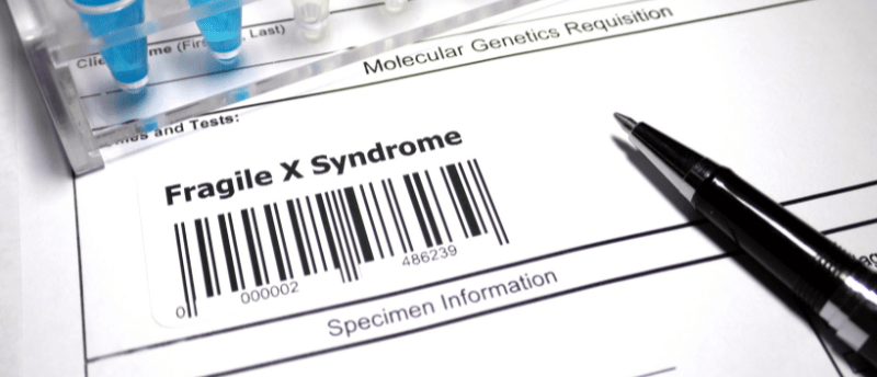 Blood biomarkers for Fragile X Syndrome